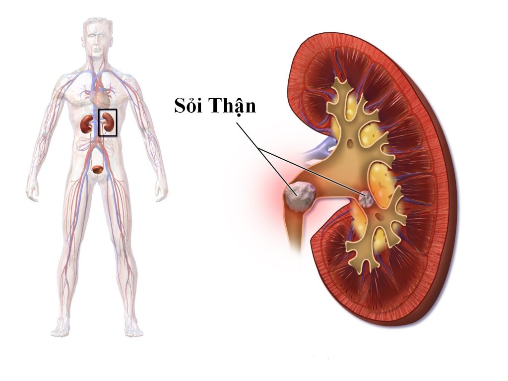 Vì sao mật vịt chữa sỏi thận ? Vì sao mật vịt chữa sỏi thận ?
